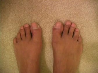 Black Foot Fetish - My Ebony Male Toes