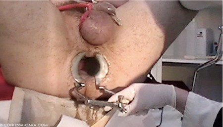 CONTESSA CARA German Femdom - Clinic Anal 5 Speculum Fisting Extreme CONTESSA CARA German Femdom - Clinic Anal 5 Speculum Fisting Extreme